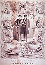 De sammenvokste Chang og Eng Bunker (1811-1874) fra Siam (Thailand) ble opphavet til betegnelsen siamesiske tvillinger. Brødrene turnerte på 1830- og 1860-tallet, men levde ellers på en gård i USA der de fikk ti og elleve velskapte barn.