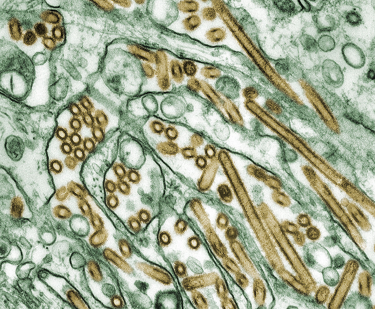 1200px Colorized transmission electron micrograph of Avian influenza A H5N1 viruses
