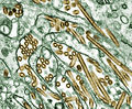 Elektronenmikroskopische Aufnahme von H5N1