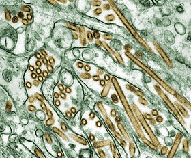 Colorized transmission electron micrograph of Avian influenza A H5N1 viruses.jpg