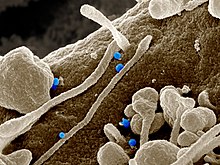 Het Krim-Congo-hemorragische koortsvirus (blauw) uit cellen van een patiënt