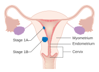 File:DIagram of the different types of soft tissue in the body CRUK 037.svg  - Wikimedia Commons