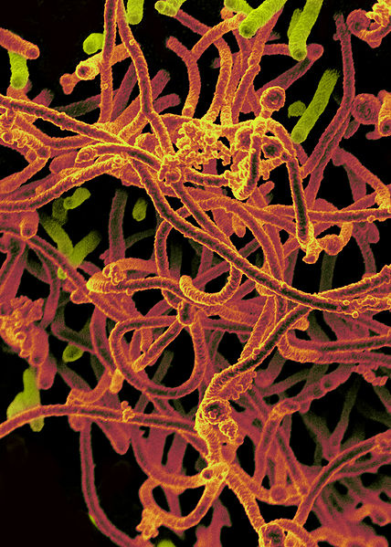 File:Ebola Virus From Mali Blood Sample (16465524896).jpg