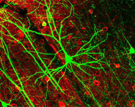 Mouse pyramidal neurons (green) and GABAergic neurons (red)[223]