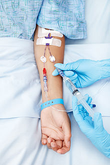 Photo of a person being administered fluid through an intravenous line or cannula in the arm