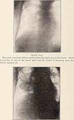 Thumbnail for File:Journal of roentgenology (1919) (14570705599).jpg