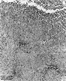 Parasite140105-fig1 Toxoplasmosis in a bar-shouldered dove - histology.tif