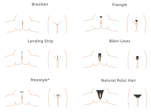 English: Different pubic hair styles. The terminology is adapted from Brazilian Waxing.