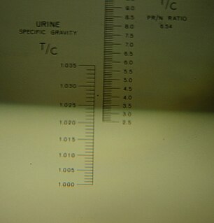 <span class="mw-page-title-main">Urine specific gravity</span>