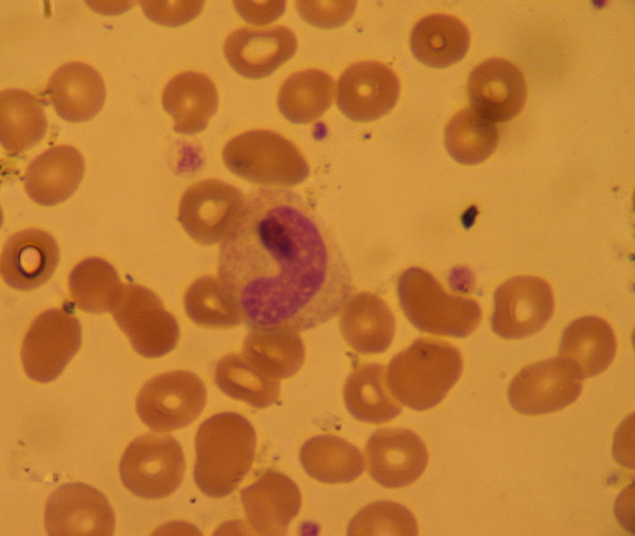 File:Band neutrophil.JPG