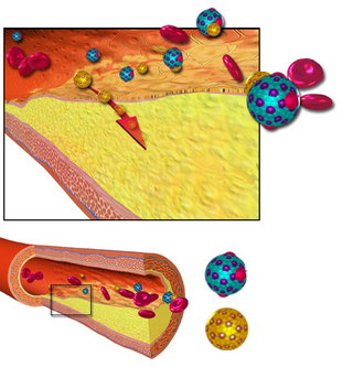 <span class="mw-page-title-main">Arteriosclerosis</span> Thickening, hardening and loss of elasticity of the walls of arteries