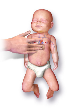 Baby jumping - Wikipedia