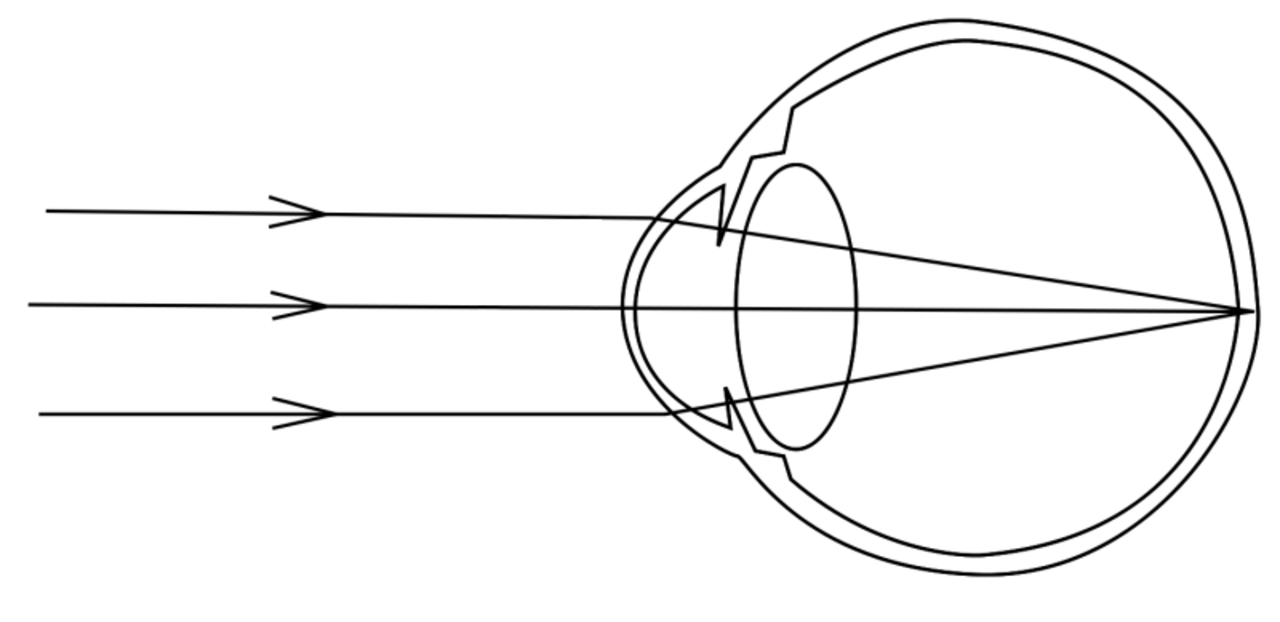 Нормальное зрение схема