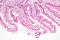 Микрофотография, показывающая лямблиоз на дуоденальной биопсии (H&E stain)