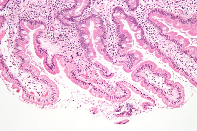 File:Giardiasis duodenum low.jpg