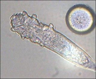 <i>Demodex folliculorum</i> Species of mite