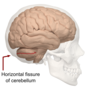 Thumbnail for Horizontal fissure of cerebellum