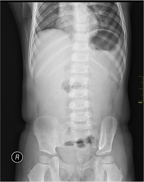 File:Medical X-Ray imaging SCM07 nevit.jpg
