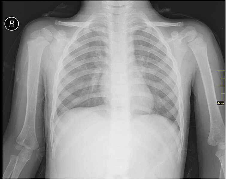 File:Medical X-Ray imaging TQU07 nevit.jpg
