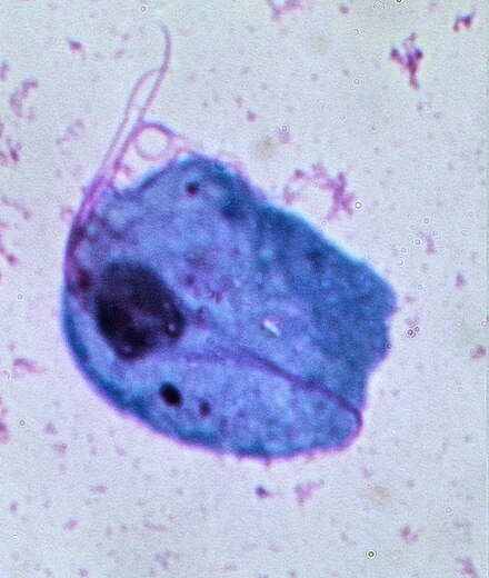 Micrograph showing _Trichomonas vaginalis_ using May-Grünwald staining