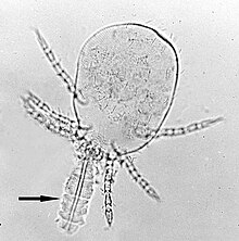 Chigger with its stylostome (arrowhead), the feeding apparatus. Trombicula-larva-stylostome.jpg