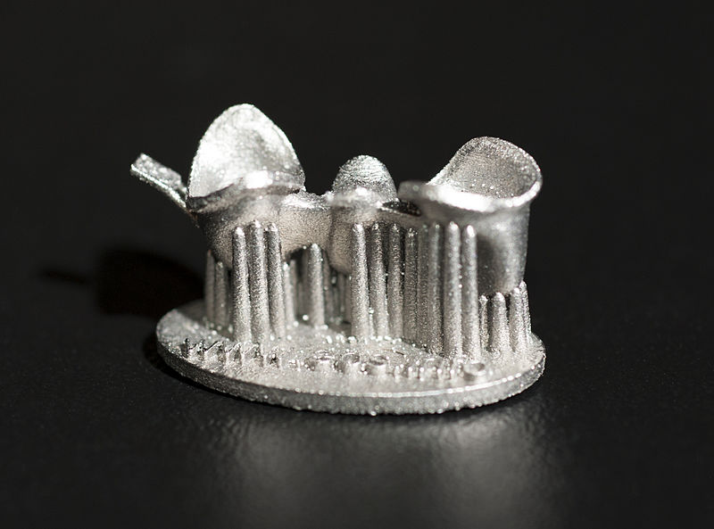 File:3-D Printed Dental Cap (5172) (18466043146).jpg