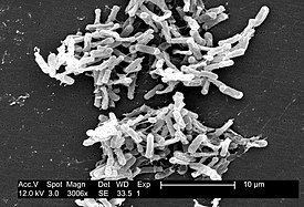 Clostridium difficile