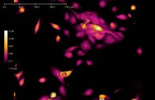 File:Digital holographic microscopy video showing cell division of unlabeled JIMT-1 breast cancer cells..ogv