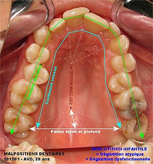 Anatomie Humaine Langue: Anatomie, Papilles gustatives, Innervation