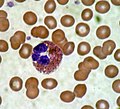 Article: Eosinophil granulocyte