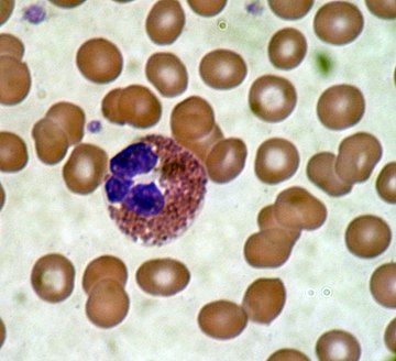 Eosinophilie