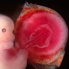 Feto umano impiantato nella mucosa uterina, con la placenta.