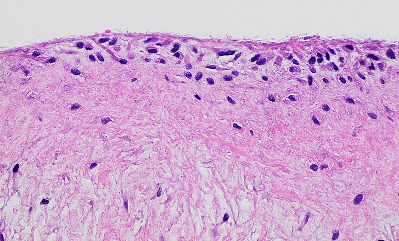 File:Histology of synovial membrane.jpg