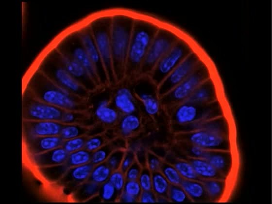 Good Looking internalin File Listeria Monocytogenes Internalin B Activates Junctional Endocytosis To Accelerate Intestinal Ppat 1000900 S006 Ogv Wikimedia Commons