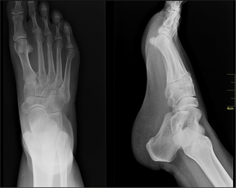 File:Medical X-Ray imaging BMK02 nevit.jpg