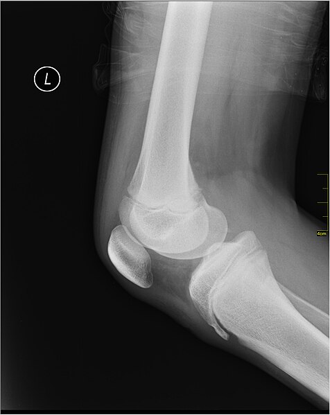 File:Medical X-Ray imaging QLA06 nevit.jpg