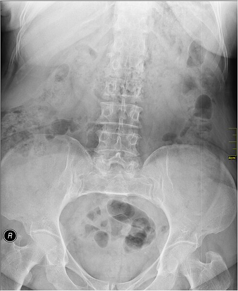 File:Medical X-Ray imaging TRY07 nevit.jpg