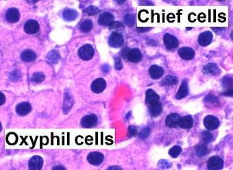 Parathyroid oxyphil and chief cells - annotated.jpg