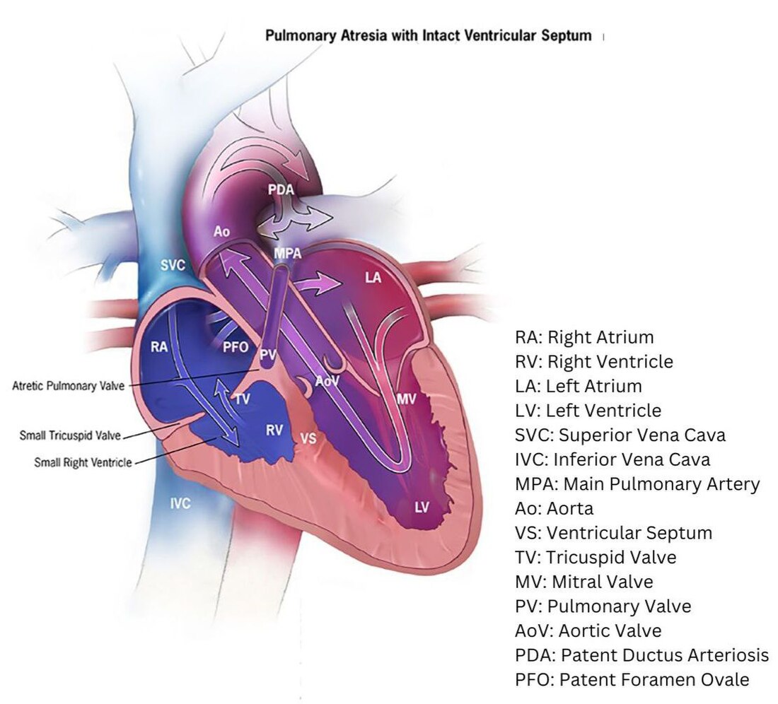 Pulmonalatresie