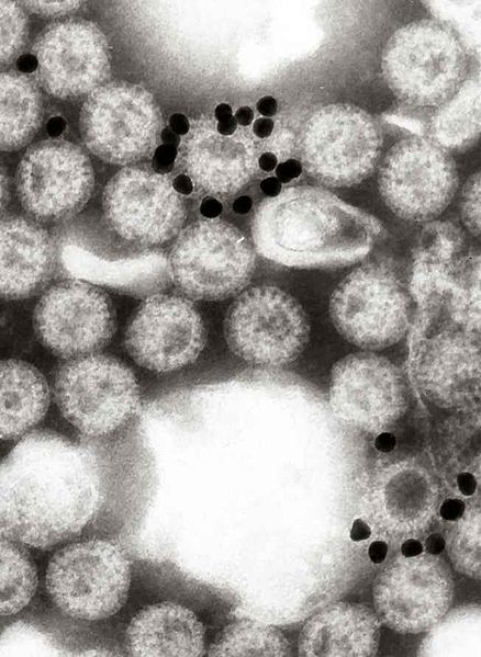 File:Rotavirus with gold- labelled monoclonal antibody.jpg