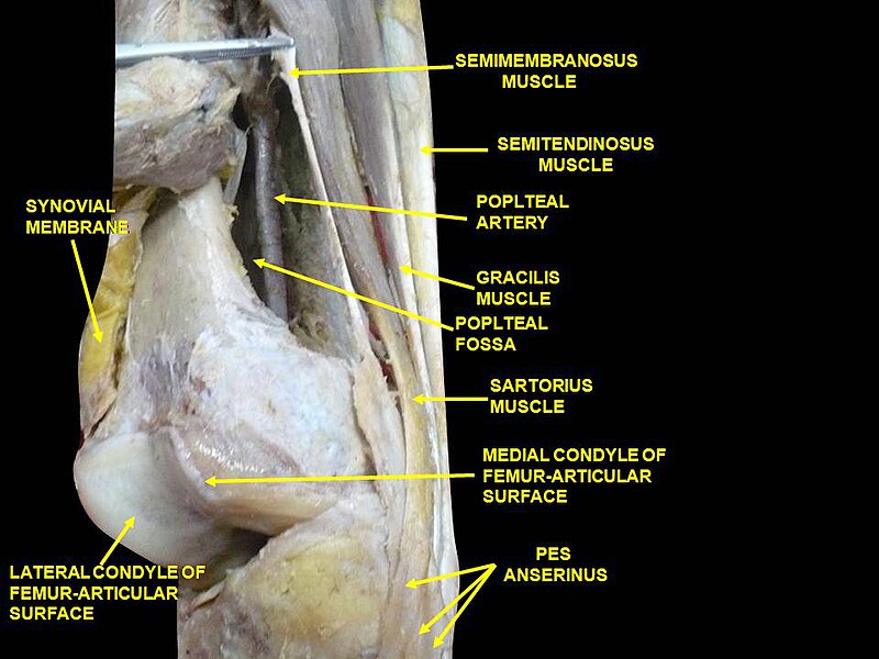 Pes anserine bursitis - Wikipedia