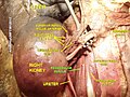Muscle grand psoas