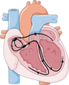 Heart conduction 2