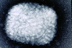 Electron micrograph of smallpox virus.jpg