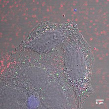 Fluorescent nanodiamonds surrounding living HeLa cells Fluorescent nanodiamonds surrounding living HeLa cells.jpg
