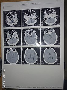 Магнитно-резонансная томография.jpg