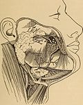 Thumbnail for File:Anatomy, physiology and hygiene for high schools (1900) (14778303171).jpg