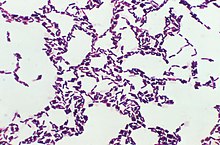 Bacillus coagulans 01.jpg