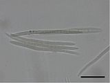 Conidia of Pseudocercospora rhinacanthi. Scale bar = 10 µm.
