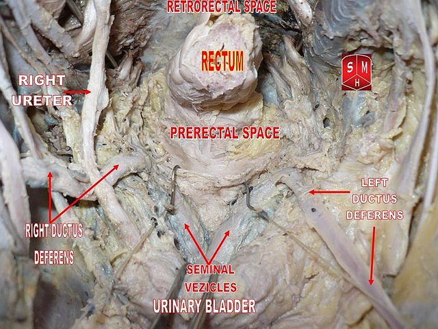 File:Male pelvic cavity.jpg - Wikipedia